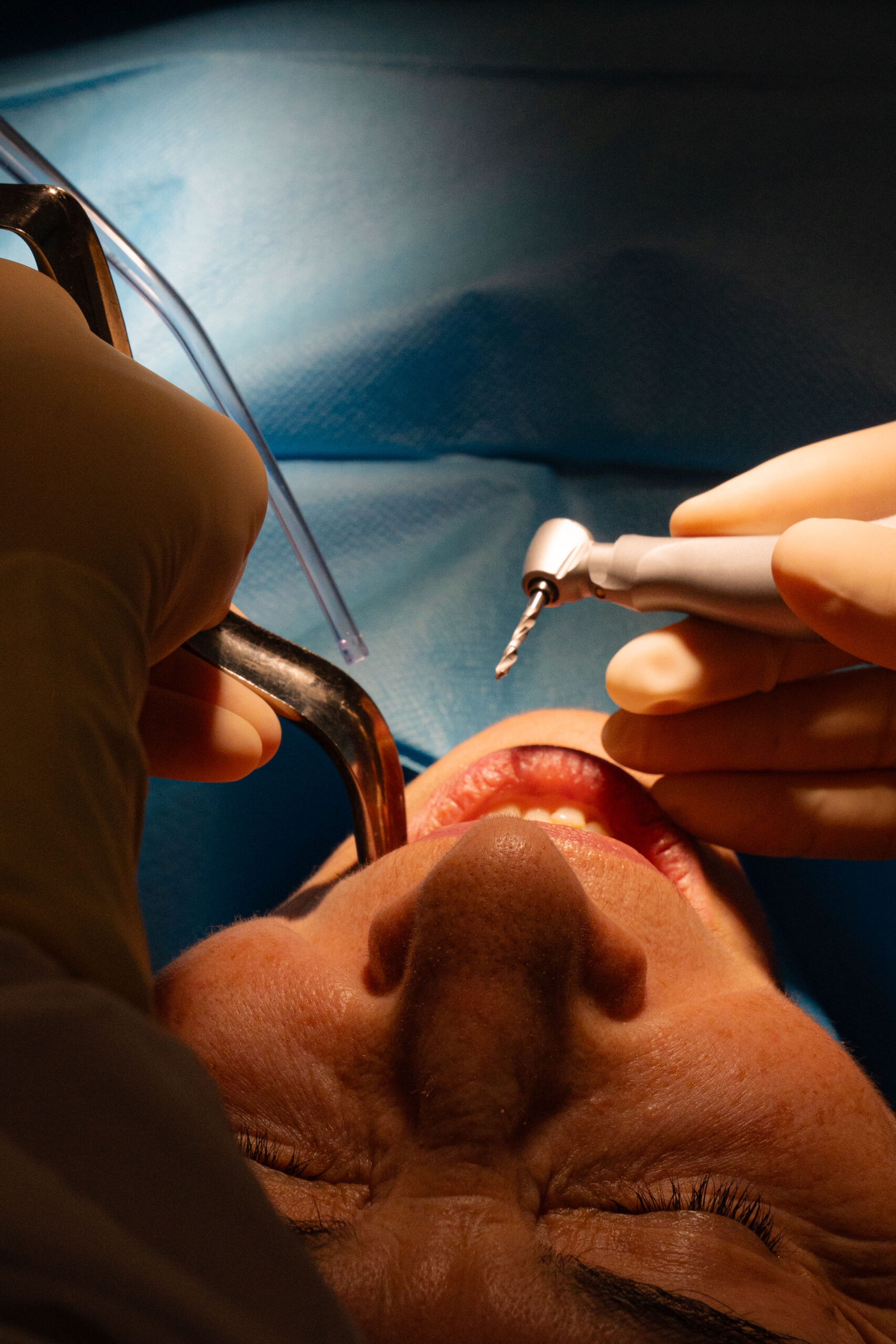 Cirugía maxilofacial
